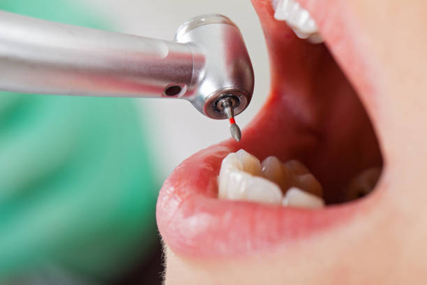 Best Pediatric Emergency Dentist in Boise City, OK